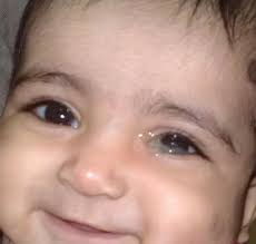 Infeksi juga bisa menyebabkan mata bayi berair, tak terkecuali konjungtivitis dan bintitan. Topik Mata Bertahi Farmasi Iman Sdn Bhd Facebook