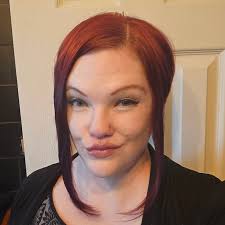 Why is my property producing goth balls?