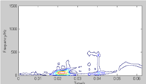 The Choi Williams Time Frequency Chart Of Scattering Light