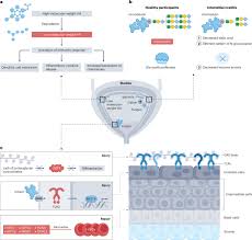 Image result for Interstitial Cystitis