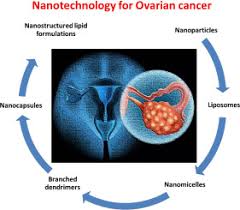 Recognizing the symptoms of ovarian cancer can lead to a diagnosis in an earlier, more curable stage. Nanotechnology In Ovarian Cancer Diagnosis And Treatment Sciencedirect