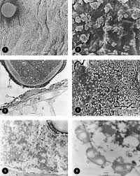 Image result for Calycosiphonia spathicalyx