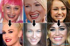 We did not find results for: 47 Celebrities With Braces Ideas Celebrities With Braces Celebrities Braces
