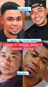 Namako io mellieur amies mintsy zahay roa io ra mpanaraka anaka ato mahay  anazy José Miraj niaraka nanao traitement nampiasa produits ko Zahay no  nanao teste de zao ny vokatra sitrana zahay