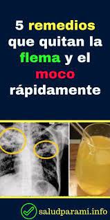 Pin En Vero