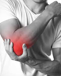 It's clinically known as lateral epicondylitis. Tennis Elbow Conditions