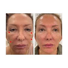 Belinda (@bellaaestheticswigan) · Wigan