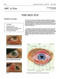 Image result for Ciliary Flush