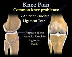 If you are over 60 years old, it may well be due to arthritis. Knee Pain Common Causes Everything You Need To Know Dr Nabil Ebraheim Youtube