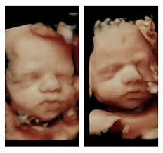 The final 4: Jack, Alfred, Harry or Hugo?