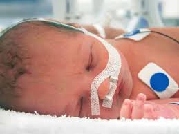 Baby born with syphilis picture. Number Of Infants Born With Syphilis Reaches 20 Year High Cdc
