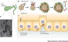 Chronic And Acute Infection Of The Gall Bladder By Salmonella Typhi Understanding The Carrier State Nature Reviews Microbiology