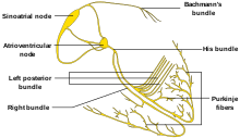 One design, the subcutaneous icd. Ù…Ù†Ø¸Ù… Ø¶Ø±Ø¨Ø§Øª Ø§Ù„Ù‚Ù„Ø¨ Ø§Ù„Ø·Ø¨ÙŠØ¹ÙŠ ÙˆÙŠÙƒÙŠØ¨ÙŠØ¯ÙŠØ§