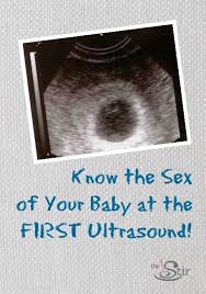 Pin On Pregnancy