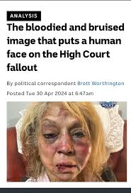 Criticism of Labour Party Supporters in Dominica Politics