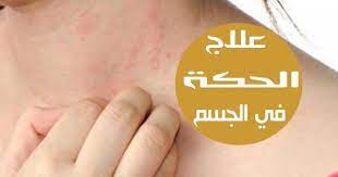 علاج الحكة في جميع انحاء الجسم حكة الجلد هي مشكلة شائعة تؤثر على كثير من الناس