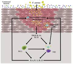 Molluscum contagiosum is a skin disease that causes painless pink bumps on the skin. The Infectious Complications Of Atopic Dermatitis Annals Of Allergy Asthma Immunology