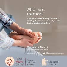 Image result for Tremor