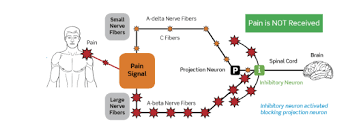 Image result for Active Labor Anesthesia