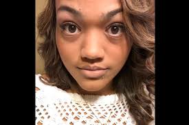 Fundraiser for Raquel Bundy by Amanda C : Support Raquel Through Kidney  Failure