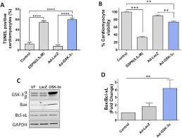 Savings + investments interest rates. Cardiomyocyte Gsk 3a Promotes Mptp Opening And Heart Failure In Mice With Chronic Pressure Overload Journal Of Molecular And Cellular Cardiology