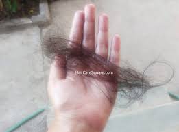 How Many Strands Of Hair Loss Per Day Is Too Many Are You Facing Severe Hair Loss Hair Keeps Falling Out Severe Hair Loss Hair Strand