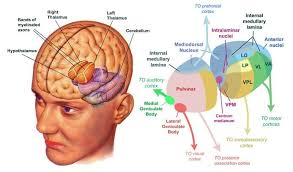 Image result for Thalamic Stimulation