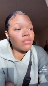 “fractures” 🦴, #original #reels