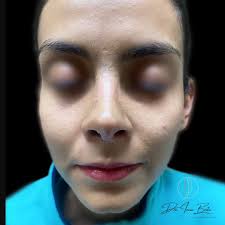 Muy feliz de terminar otro escalón. Inmensamente agradecida por haber  tenido esta oportunidad. seguiré preparándome para que en mis manos esté  aportar siempre lo mejor a esta hermosa especialidad.