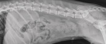 Image result for Abdominal XRay