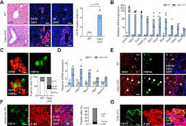 Based on android 8.1 whats working? F Actin Dynamics Regulates Mammalian Organ Growth And Cell Fate Maintenance Journal Of Hepatology