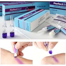 Image result for Tissue Adhesive