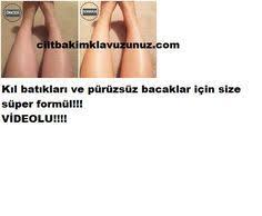 Kil Batiklari Ve Puruzsuz Bacaklar Icin En Iyi Formul Hair Beauty Beauty Health