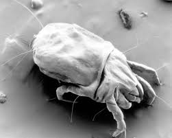 Image result for Dust mite