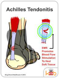 How to heal achilles tendon faster. Achilles Tendonitis Treatment