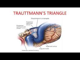 Dura containing superior petrosal sinus superiorly. Anatomical Variations In Cp Angle And Radiology Of Common Cp Angle Lesions Youtube