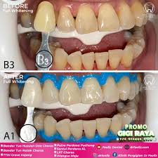 Klinik perdana putra קלאנג, סלנגור, מלזיה klinik perdana putra כתובת רופא. Fngmfv8y6pjgbm