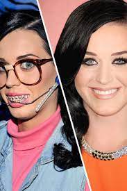 And yet, there's a good chance that your childhood does have something in common with that of brooklyn. Famous Faces With Braces Faith Hill And More Celebrities Who Had Braces