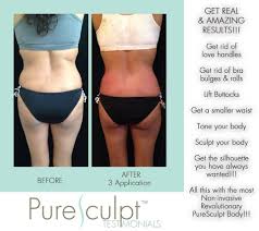 Sculpt Your Body Body Sculpting Body Treatments High Neck Bikinis