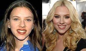10 Celebrity Plastic Surgeries Gone Good Indiatoday