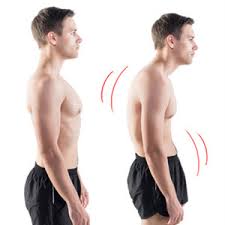 True fit posture scam if you are constantly slouching and have bad p… baca selengkapnya true fit posture scam : Forward Head Posture Fix Review 2021 And Recommendations