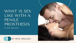 What is sex like with a penile prosthesis | St Pete Urology
