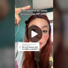 Radiografía de tórax: Proyección AP y PA explicadas