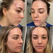 Audrey Crews, APRN, FNP-C