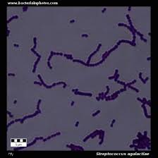 Image result for Group B Streptococcus