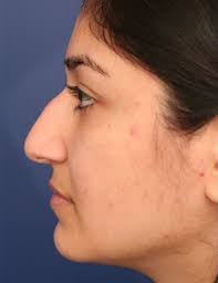 Gallery Cases Archive