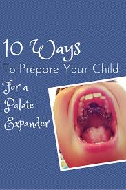 Watch the video explanation about expander & braces experience: 10 Ways To Prepare Your Child For A Palate Expander Palate Expander Braces Tips Expanders For Teeth