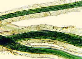 Image result for Microcoelia physophora