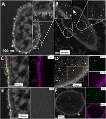 This page is about the various possible meanings of the acronym, abbreviation, shorthand or slang term: Novel Catalytically Active Pd Ru Bimetallic Nanoparticles Synthesized By Bacillus Benzeovorans Scientific Reports