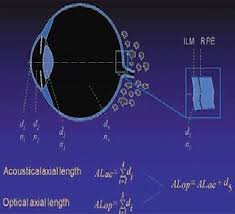Pin On Ophthalmology